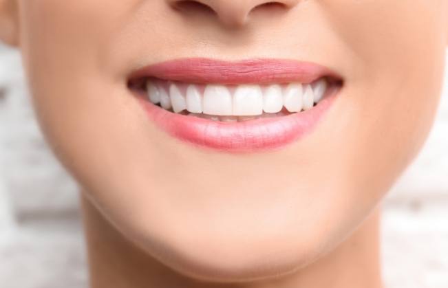 Closeup of flawless smile after cosmetic dental bonding