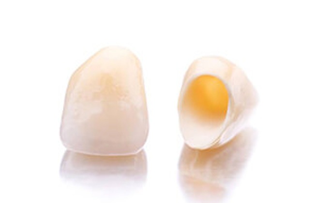 Two all ceramic dental crowns on a table top