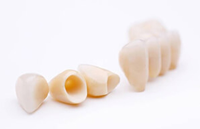 Several all ceramic dental crowns