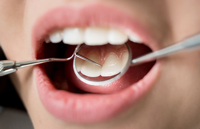 Closeup of smile during dental checkup and teeth cleaning visit