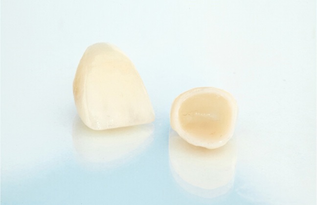 A close-up of dental crowns in Kent