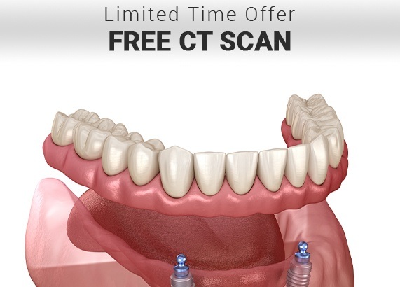 Free C T cone beam scan special coupon