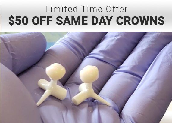 CEREC same day dental crown special coupon