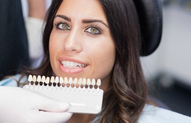 Woman's smile compared with veneers color chart