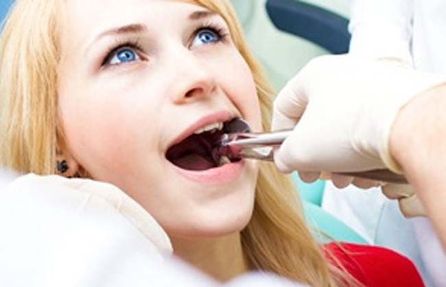 Woman having wisdom tooth extracted