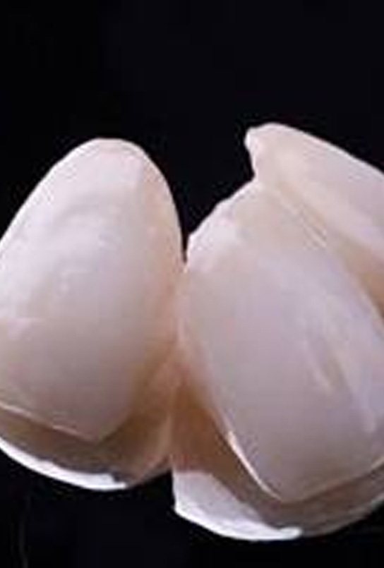 Closeup of full zirconia dental crowns prior to placement
