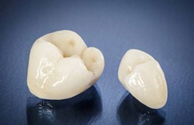 Two full zirconia dental crowns prior to placement