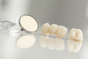 Did you know that your dental bridges in Kent can blend seamlessly among your natural teeth?