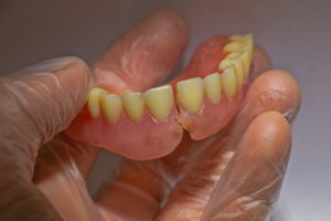 a person holding a broken denture in their hands